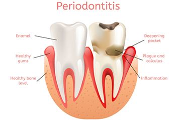 Periodontics Agra